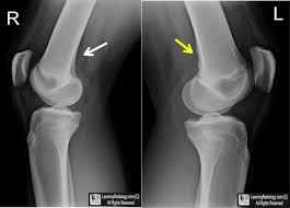 Learningradiology Radiology Technologist Rad Tech Radiology