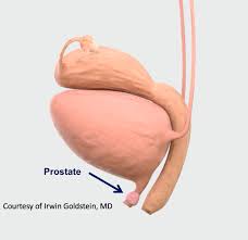 Pain in bones, especially the lower back, hips or pelvis. The Female Prostate Fact Or Fiction