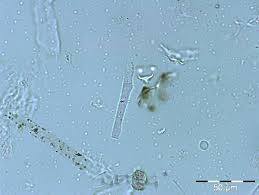 Image result for Psilotrichum sericeum