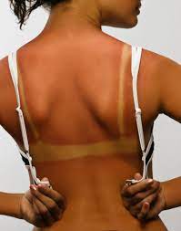Ways To Stop Peeling & Keep A Tan