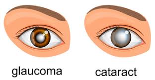 It can affect people of all. Glaucoma Symptoms Types Diagnostics Treatment In Delhi