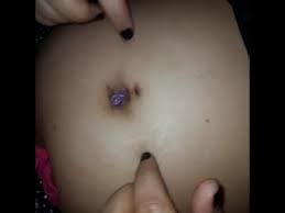 Explore a wide range of the best navel needle on aliexpress to find one that suits you! Wife Navel Stabbed By Needles