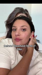 Handsome Squidward Face Transformation Explained