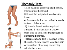 Image result for Thessaly Test