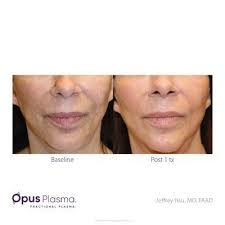 About Face Skin Care, 3695 Braselton Hwy, Ste 300, Dacula, GA 30019, US