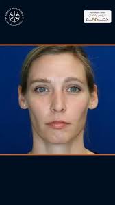 استقبلي رمضان بجمال متجدد مع عائلة إنفيلد رويال! ✨, نتمنى لكم شهرًا مباركًا  مليئًا بالجمال والراحة، وكل عام وأنتم بخير! 🌙💖, استمتعي بخصم 50% على جميع  خدماتنا خلال شهر رمضان، واحجزي الآن استشارة مجانية ...