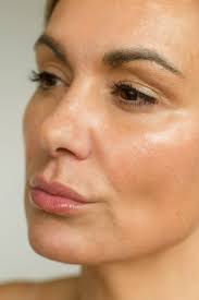 Best Med Spa in Denver, Boulder & Fort Collins, Colorado