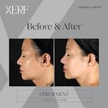 XERF DAY