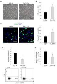 Biomolecules Free Full Text Sertoli Cells Improve Myogenic Differentiation Reduce Fibrogenic Markers And Induce Utrophin Expression In Human Dmd Myoblasts Html