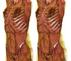 The cartilage may become subluxated, causing pain and possible nerve impingement. Female Torso Female Torso Human Anatomy Reference Human Anatomy