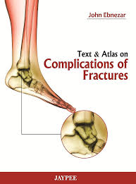 Image result for Fracture Complication