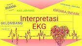 Maybe you would like to learn more about one of these? Soal Dan Cara Menginterpretasikan Ekg Part 2 Youtube