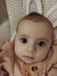 What are these bumps