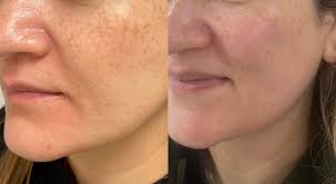 Val Fleury Skincare™️