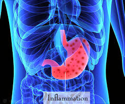 Gastroenteritis can be very unpleasant, but it usually clears up by itself within a week. Test Your Knowledge On Gastroenteritis