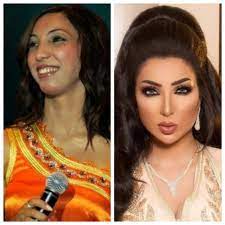 ربك لما يدي إوعك تفتري. Ø¯Ù†ÙŠØ§ Ø¨Ø·Ù…Ø© ØªØµØ¯Ù… Ø¬Ù…Ù‡ÙˆØ±Ù‡Ø§ Ø¨ØµÙˆØ±Ø© Ù…Ø³Ø±Ø¨Ø© Ù‚Ø¨Ù„ Ø¹Ù…Ù„ÙŠØ§Øª Ø§Ù„ØªØ¬Ù…ÙŠÙ„ Ù…ÙŠ Ø§Ù„Ø¹ÙŠØ¯Ø§Ù† ØªØ¹Ù„Ù‚ Ø§Ù„ÙˆÙØ¯