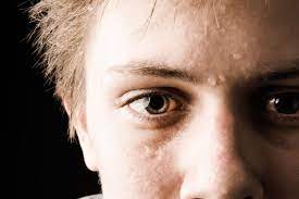 It would be intolerable and immoral for the government or business to coerce someone, and their family, to take a covid vaccine against their will to avoid a. Covid Vaccine Side Effects My Week Of Horror And Joy After I Got My Second Dose