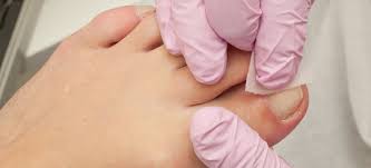 Maybe you would like to learn more about one of these? What To Do About Painful Ingrown Toenails Certified Foot