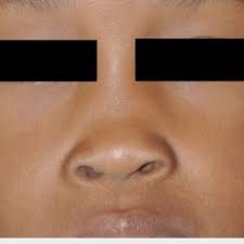 Chloe B. Harrington's research works