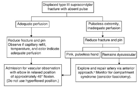 Supracondylar Fracture Pediatric Pediatrics Orthobullets