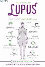 Slideshow A Visual Guide To Lupus Lupus Facts Lupus Symptoms Lupus