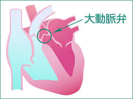 大動脈弁狭窄症とは|医療法人徳洲会 岸和田徳洲会病院