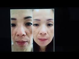 Grace Chew Maqnifiq Collagen Testimonial Part 2