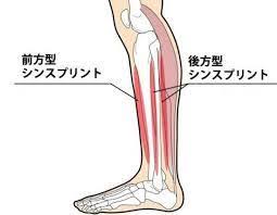 마법과 고교 열등생 5권 택본 31권 32권pdf 입니다. åŽŸå› ã¨ç—‡çŠ¶ æ²»ç™‚æ³•