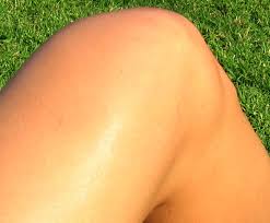 ركبة ويكيبيديا