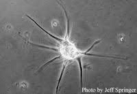 Image result for Dissotis falcipila