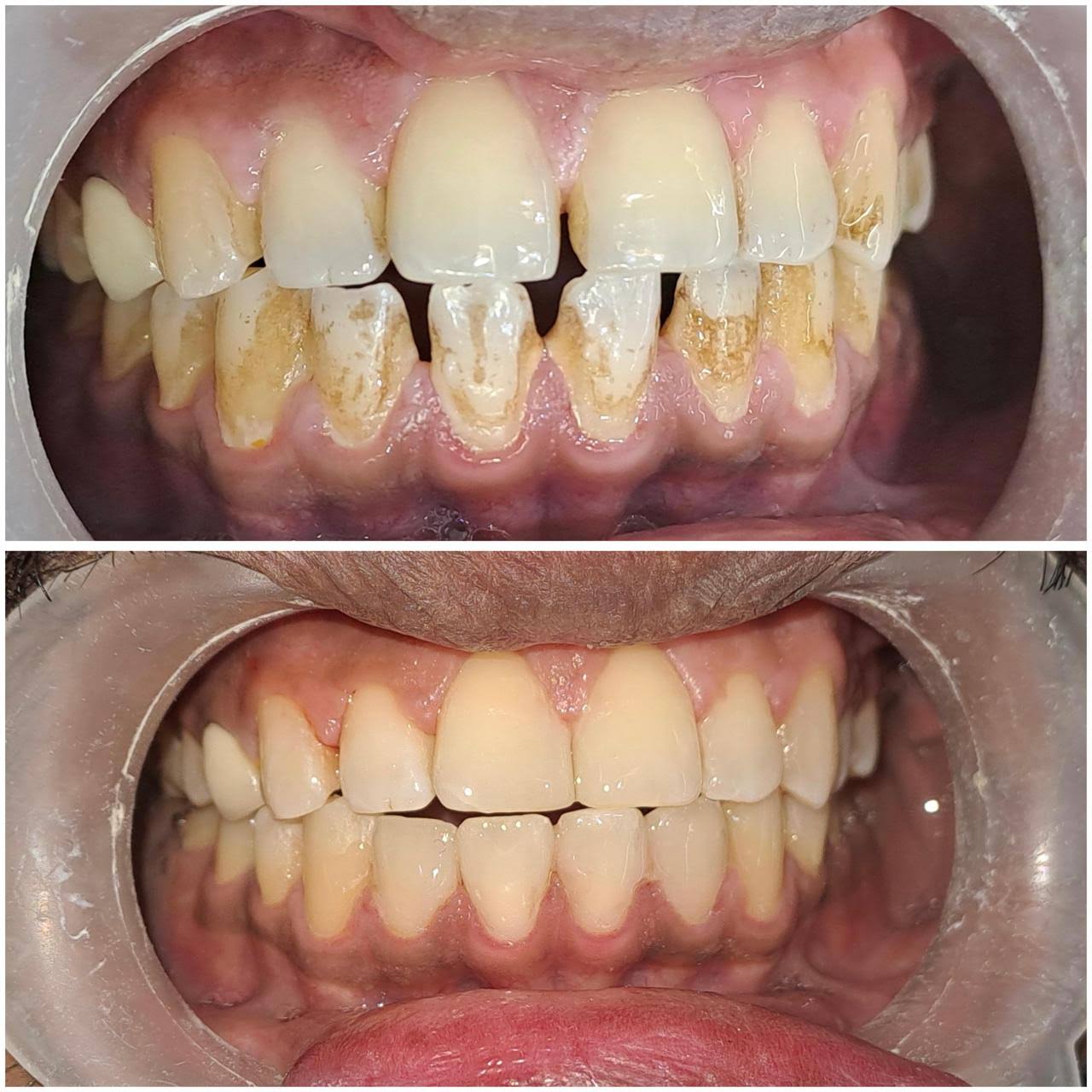 Dental product image