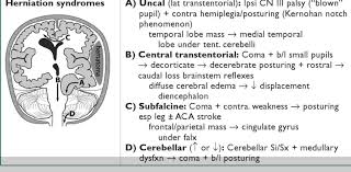 Pocket Neurology Neurology Medical Knowledge Brain Images