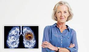 Or, they may not have had any known lung cancer risks. Lung Cancer Symptoms Risk Factors Of The Deadly Disease Include Second Hand Smoke Express Co Uk
