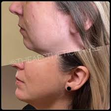 Best Medical Spa in Mandeville LA