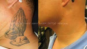 Maybe you would like to learn more about one of these? Benchmark Tattoo Fade Away Laser Tattoo Removal Duluth Mn Cylex