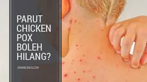Ketika merawat anak kucing dari kecil dan tanpa induk memang memerlukan ketekunan selama beberapa bulan pertama. Parut Chicken Pox Boleh Hilang Dengan Cepat Anda Boleh Amalkan Sendiri Nanti Ziana Eunos