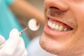 How long does a dental cleaning take? What To Expect At Your Teeth Cleaning Wildwood Dental Clinic