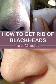 Life Saving Beauty Hacks For Girls Get Rid Of Blackheads Blackheads Moisturizing Face Cream