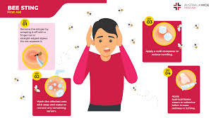 First Aid for Bee Stings