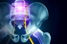 Learn about the possible causes of hip pain and common ways to get relief from if your hips are sore, here is a rundown of what might be causing your discomfort and how to get when osteoarthritis becomes so severe that the pain is intense or the hip joint becomes deformed, a. Reasons Your Hips May Hurt