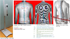 For instance, maps constitute both the input and output of a gis. Standard Reference Values Of The Upper Body Posture In Healthy Middle Aged Female Adults In Germany Scientific Reports