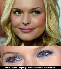 Collection Of Celebrities With Heterochromia Eyes Different Colored Eyes Heterochromia Kate Bosworth