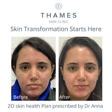 Best medical and facial aestheticians in Surrey & SW London