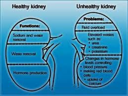 Info On Healthy Kidney Vs Unhealthy Kidney Healthy Kidneys Kidney Health Kidney