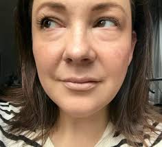 Over 40 Beauty: A Cure for Raccoon Eyes