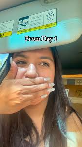 Look at her go 🥹. I do have to get two extractions before I get my bottoms  braces row done 😫.