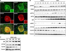Mar 06, 2020 · made in hong kong: Differential Regulation Of Endoplasmic Reticulum Stress By Protein Tyrosine Phosphatase 1b And T Cell Protein Tyrosine Phosphatase Journal Of Biological Chemistry