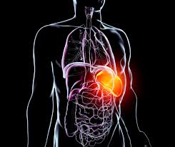 Image result for Splenomegaly