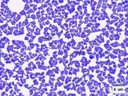 It encourages the growth of a group of certain bacteria while inhibiting the growth of others. Pin On Giggles