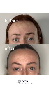 Meet Dr Ryan ✨🥳 Dr Ryan pursued postgraduate training at the Cosmed  Aesthetic Training Academy in Dublin, completing advanced certificates in  Botulinum toxin and Dermal Fillers. He is deeply committed to facial